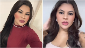Jovem que teve mãos decepadas em tentativa de feminicídio no Ceará aprende a usar celular com os pés