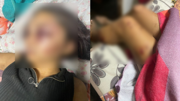 Adolescente que foi sequestrada e teve rosto desfigurado por namorado no Ceará já tinha sido agredida por ele há um ano