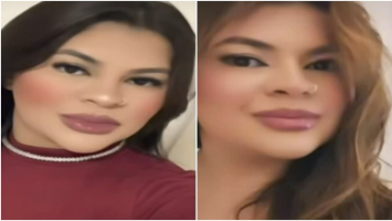 Mãos reimplantadas em jovem amputada pelo ex começam a mexer, diz família