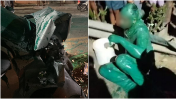 Justiça concede liberdade a vereador preso por acidente de trânsito que deixou motorista verde no Ceará