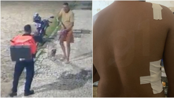 Justiça manda soltar PM que atirou em entregador e decide que suspeito responda por lesão corporal